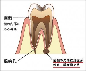 画像４