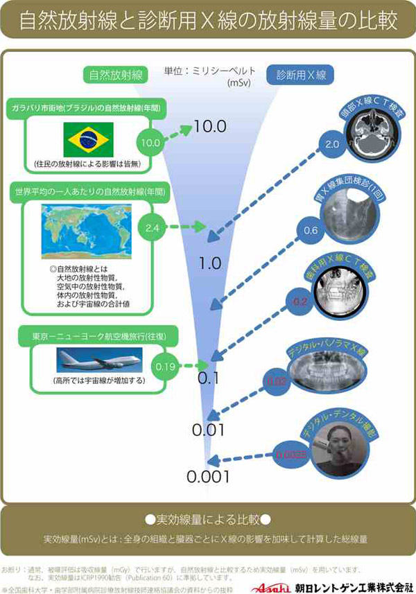 放射線量の比較